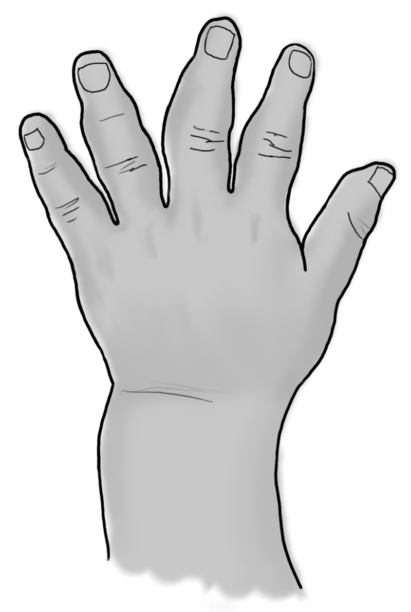 Disorders of Musculoskeletal Growth and Development