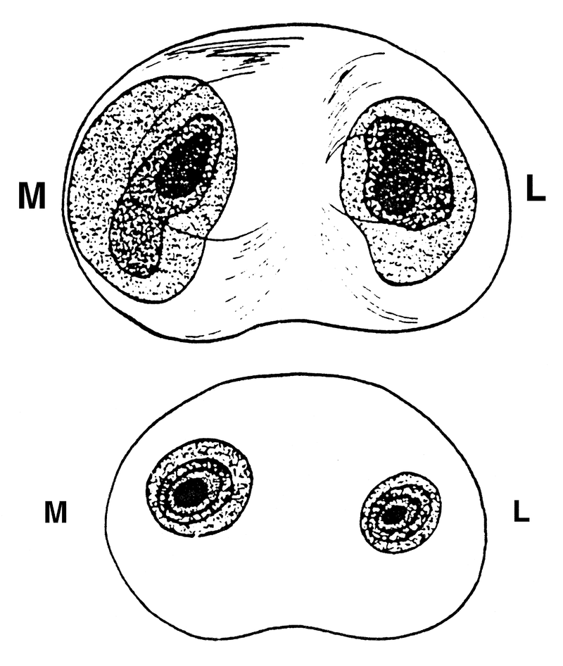 Meniscus and Intervertebral Disks