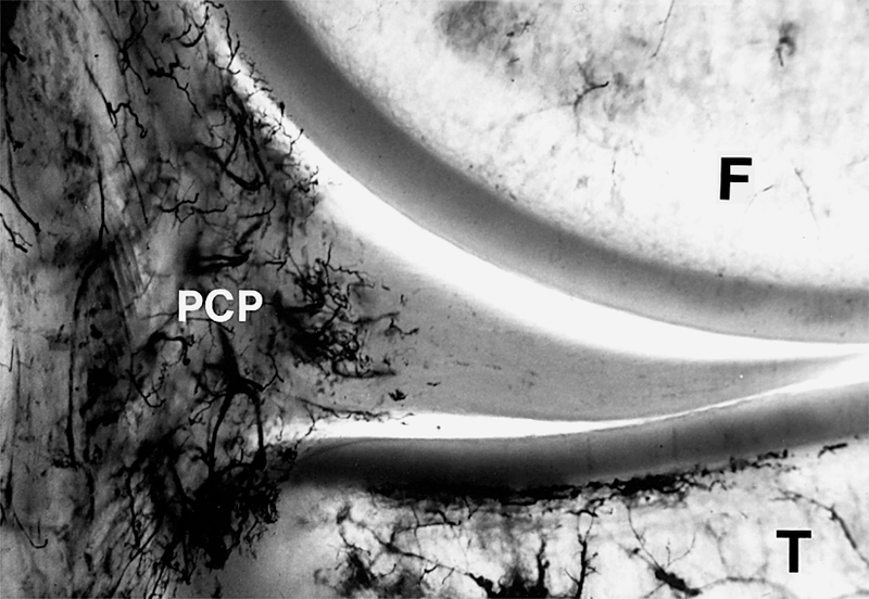 Meniscus and Intervertebral Disks