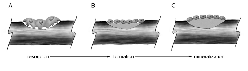 Metabolic Bone Disease